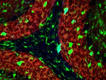 PAX2GFP